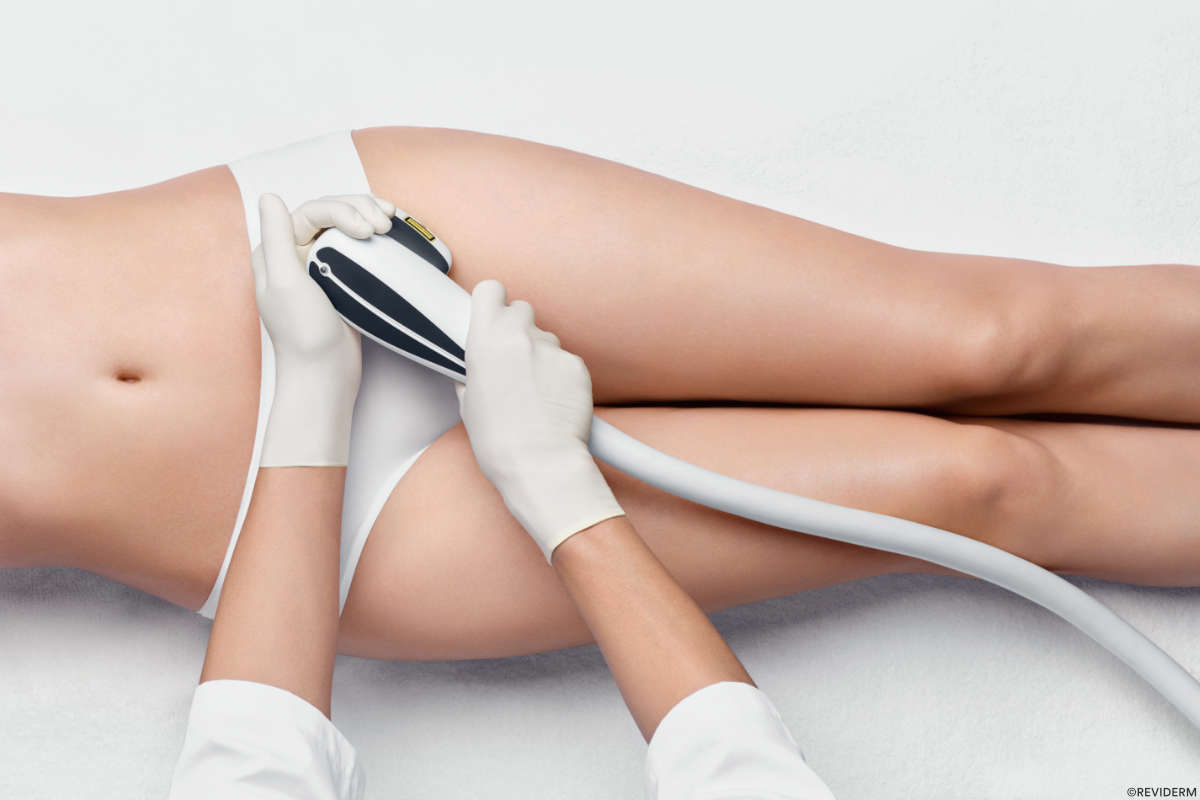 dauerhafte haarentfernung